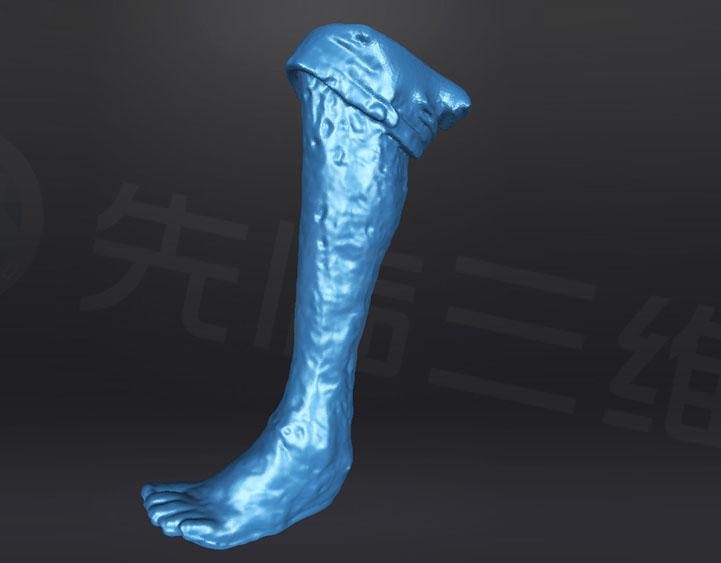 定制康复足托案例